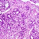 Trinocular Biological Microscope